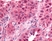 Anti EGR1 Antibody thumbnail image 1