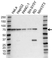Anti EIF2AK2 Antibody (PrecisionAb Polyclonal Antibody) thumbnail image 1