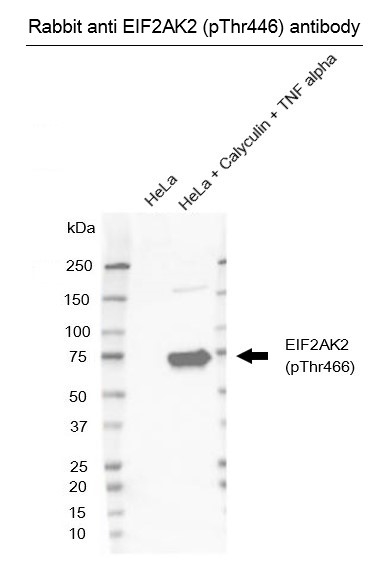 Anti EIF2AK2 (pThr446) Antibody thumbnail image 2