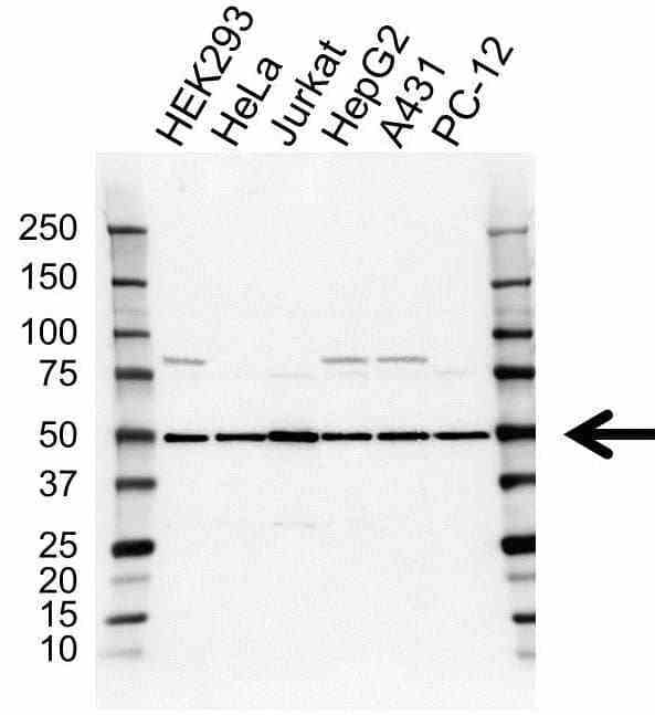 Anti EIF2S2 Antibody (PrecisionAb Polyclonal Antibody) gallery image 1