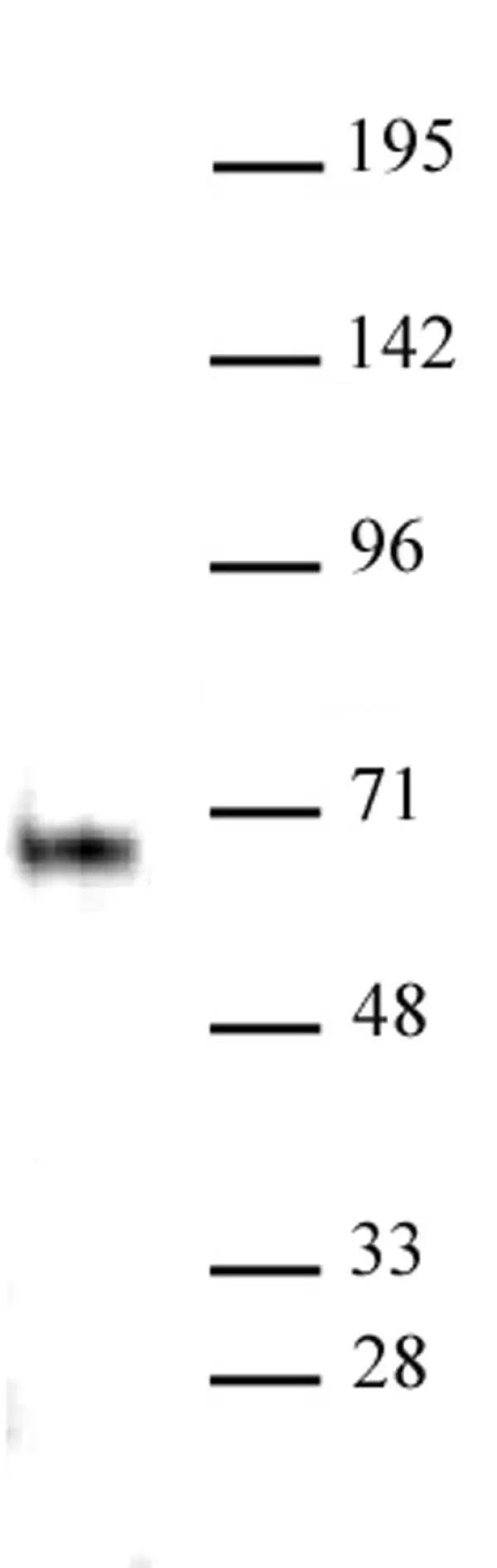 Anti Human ELK-1 Antibody gallery image 2