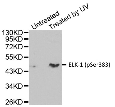 Anti ELK-1 (pSer383) Antibody thumbnail image 1