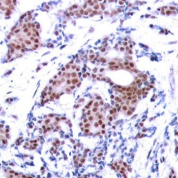 Anti ELK-1 (pSer383) Antibody thumbnail image 2