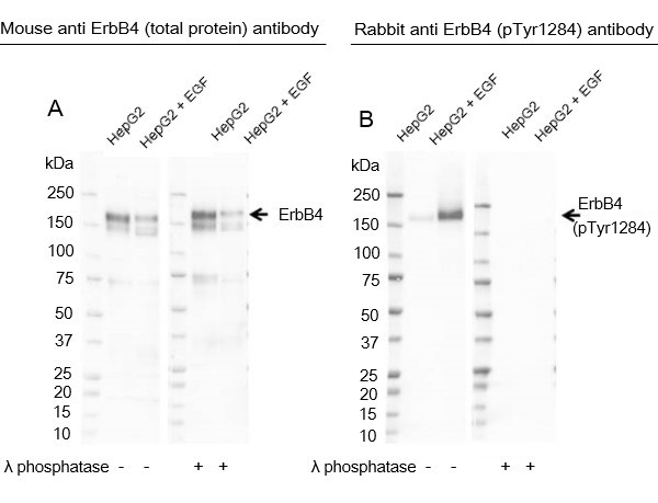 Anti ErbB4 (pTyr1284) Antibody (Polyclonal Antibody Antibody) gallery image 1