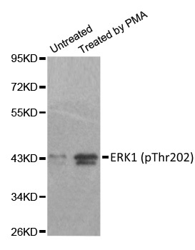 Anti ERK1 (pThr202) Antibody gallery image 1