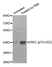 Anti ERK1 (pThr202) Antibody thumbnail image 1