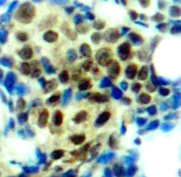 Anti ERK1 (pThr202) Antibody gallery image 2