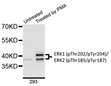 Anti ERK1 (pThr202/pTyr204)/ERK2 (pThr185/pTyr187) Antibody gallery image 1