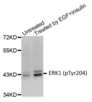 Anti ERK1 (pTyr204) Antibody gallery image 1