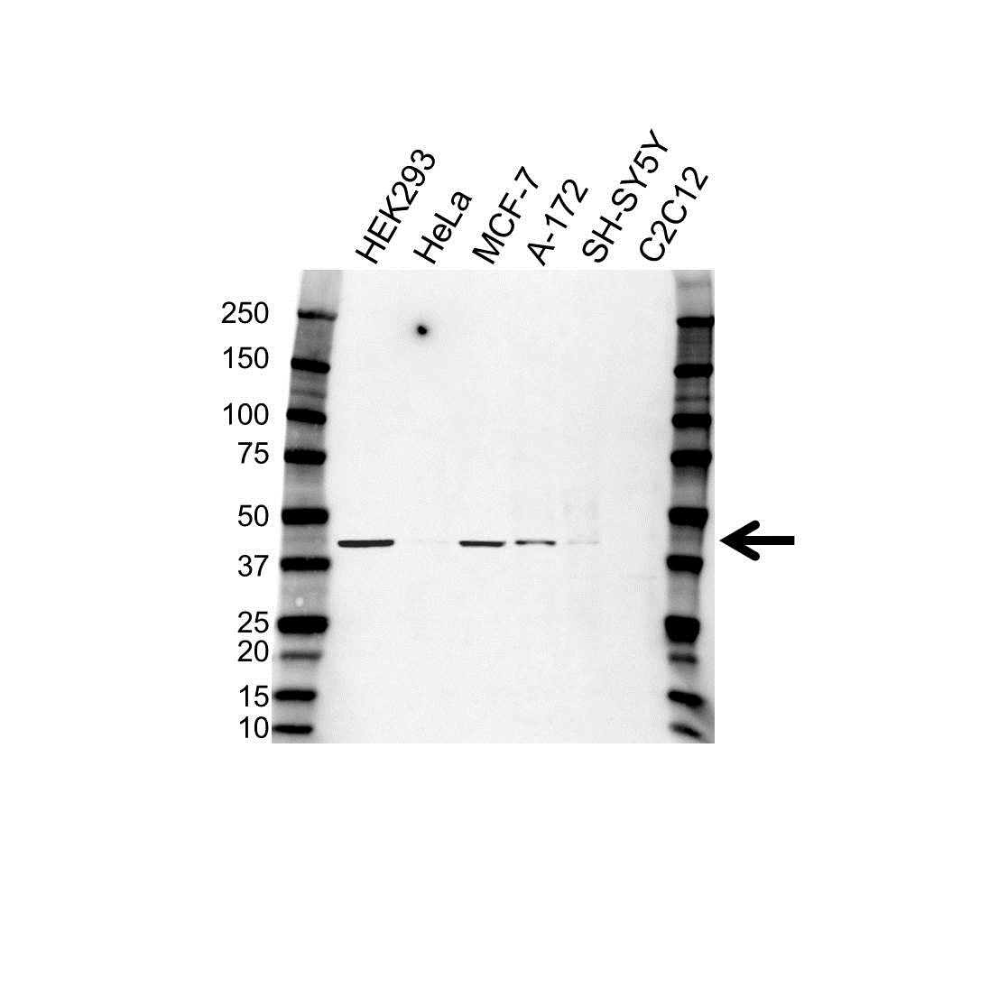 Anti ERLIN-2 Antibody (PrecisionAb Polyclonal Antibody) gallery image 1