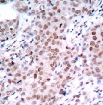 Anti Estrogen Receptor Alpha (pSer104) Antibody gallery image 2