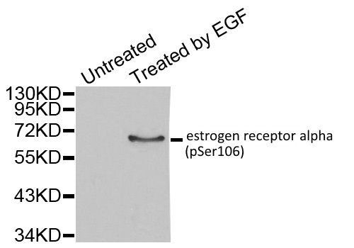 Anti Estrogen Receptor Alpha (pSer106) Antibody gallery image 1