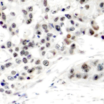 Anti Estrogen Receptor Alpha (pSer106) Antibody gallery image 2