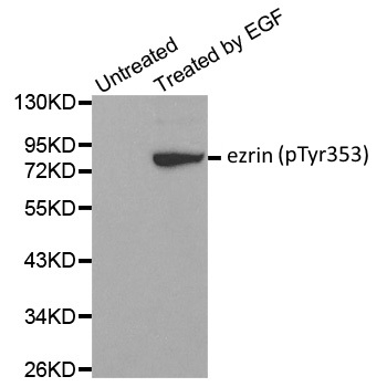 Anti Ezrin (pTyr353) Antibody gallery image 1