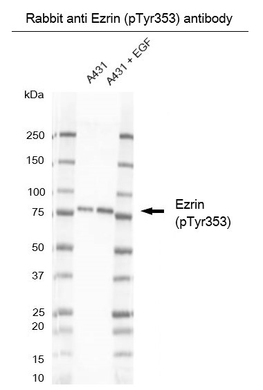 Anti Ezrin (pTyr353) Antibody thumbnail image 3