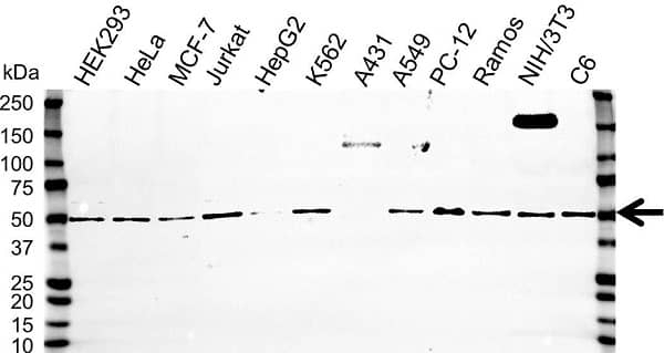 Anti FADS1 Antibody (PrecisionAb Polyclonal Antibody) gallery image 1