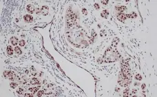 Anti Human FGF Basic Antibody gallery image 1