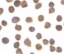 Anti Human FLIP L (C-Terminal) Antibody gallery image 2