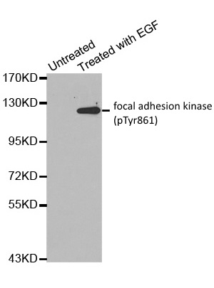 Anti Focal Adhesion Kinase (pTyr861) Antibody gallery image 1