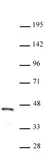 Anti Human FOXL2 Antibody thumbnail image 1