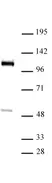 Anti Human FOXM1 Antibody thumbnail image 1