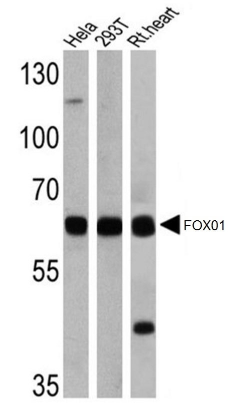 Anti FOXO1 Antibody gallery image 1
