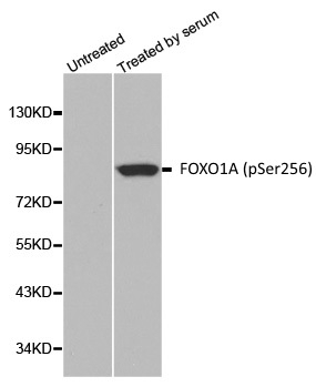 Anti FOXO1A (pSer256) Antibody gallery image 1