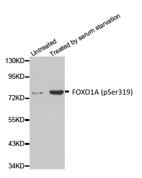 Anti FOXO1A (pSer319) Antibody gallery image 1