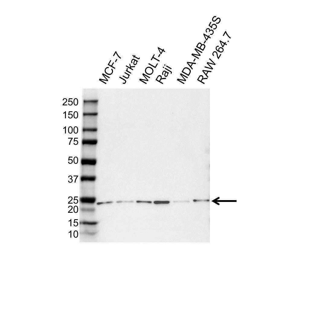 Anti Frataxin Antibody (PrecisionAb Polyclonal Antibody) gallery image 1