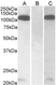 Anti Human Furin (C-Terminal) Antibody thumbnail image 1