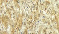 Anti Human G-CSF Antibody gallery image 1
