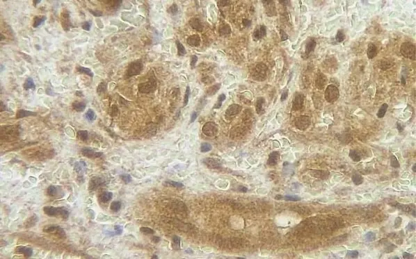 Anti Human G-CSF Antibody gallery image 2