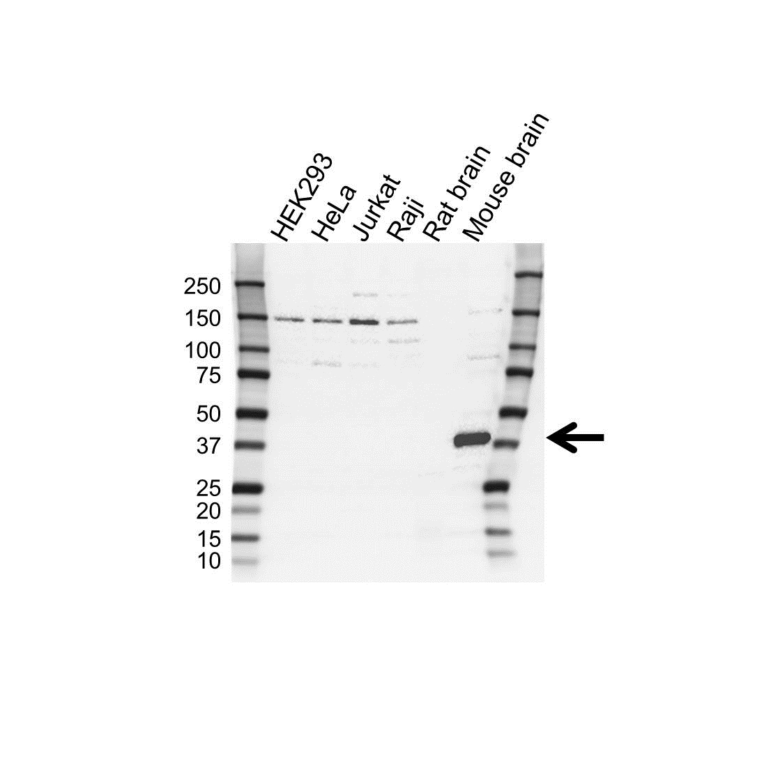 Anti G Protein Alpha Antibody (PrecisionAb Polyclonal Antibody) gallery image 1