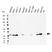 Anti Human Galectin-3 Antibody (Polyclonal Antibody Antibody) thumbnail image 1