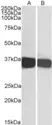 Anti Human GAPDH (C-Terminal) Antibody thumbnail image 1
