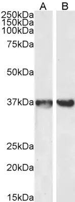 Anti Human GAPDH (C-Terminal) Antibody gallery image 2