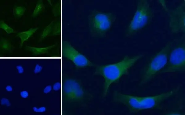 Anti Human GAPDH (C-Terminal) Antibody gallery image 3