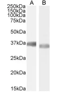 Anti Human GAPDH (C-Terminal) Antibody gallery image 4
