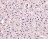 Anti GAPDH (N-Terminal) Antibody gallery image 2