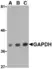 Anti GAPDH (C-Terminal) Antibody thumbnail image 1