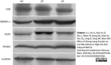 Anti GAPDH (C-Terminal) Antibody gallery image 3