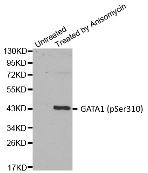 Anti GATA1 (pSer310) Antibody gallery image 1