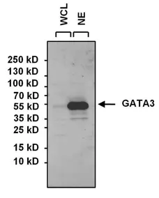 Anti GATA3 Antibody gallery image 1