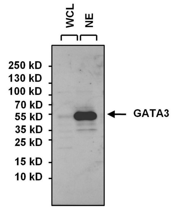 Anti GATA3 Antibody gallery image 1