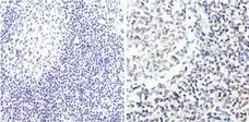 Anti GATA3 Antibody gallery image 2