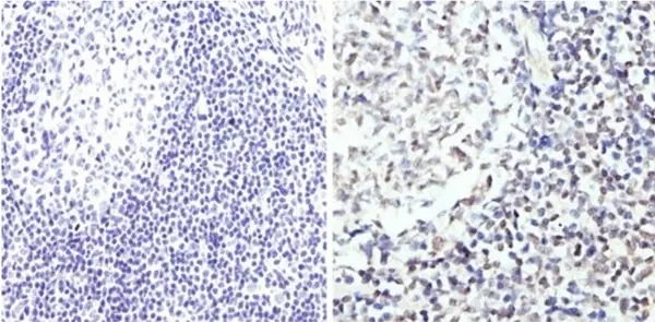 Anti GATA3 Antibody gallery image 2