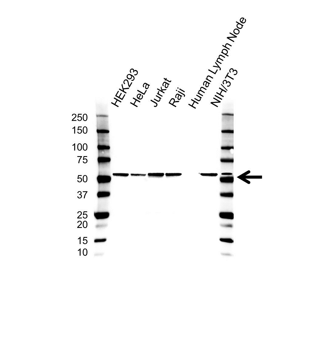 Anti GCNT3 Antibody (PrecisionAb Polyclonal Antibody) gallery image 1