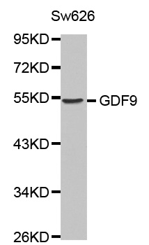 Anti GDF9 Antibody gallery image 1