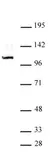 Anti Human GLI1 Antibody thumbnail image 1