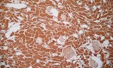 Anti Human Glucose Transporter 5 Antibody gallery image 1